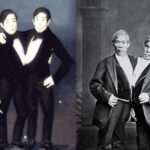 Diferencias entre gemelos y siameses