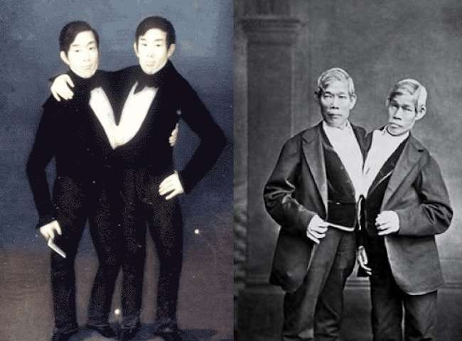 diferencias-entre-gemelos-y-siameses