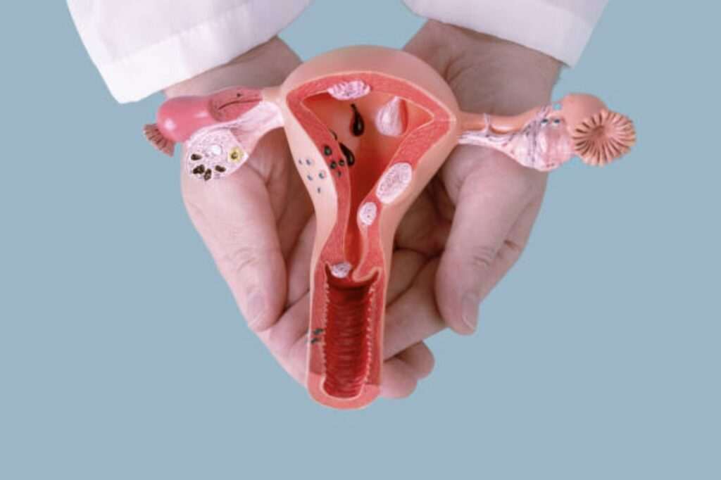 histeroscopia-todo-lo-que-necesitas-saber
