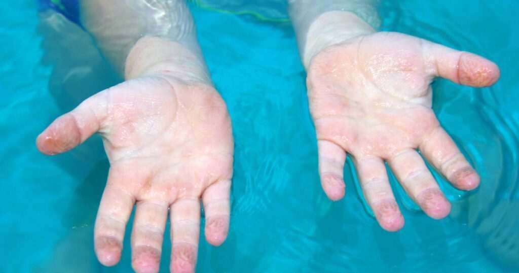 por-que-se-arrugan-las-manos-en-el-agua