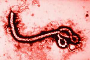 que-es-el-ebola-todo-lo-que-necesitas-saber