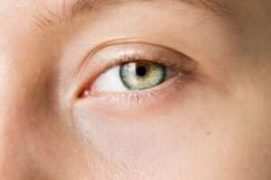 como-reducir-las-patas-de-gallo-alrededor-de-los-ojos